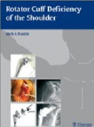 ROTATOR CUFF DEFICIENCY OF...