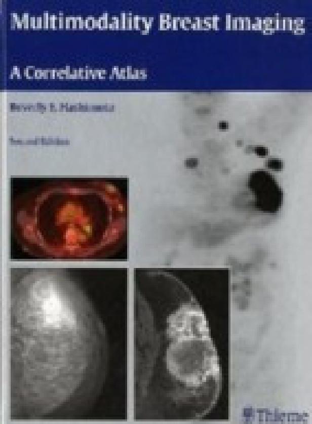 MULTIMODALITY BREAST IMAGING