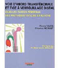 VOIE TRANSFEMORALE ET TIGE...