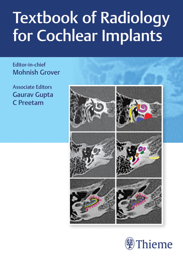 TEXTBOOK OF RADIOLOGY FOR COCHLEAR IMPLANTS