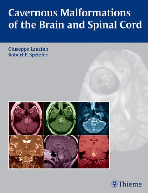 Cavernous malformations of the brain and spinal cord