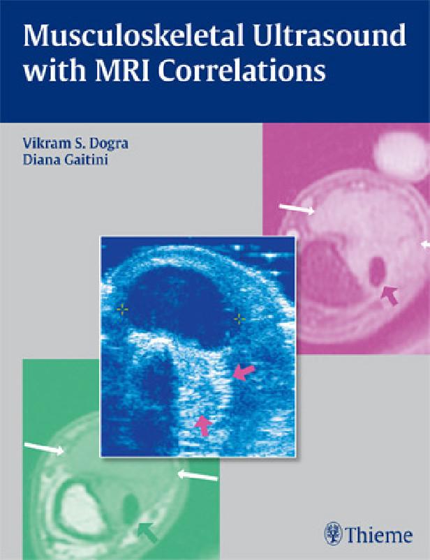 MUSCULOSKELETAL ULTRASOUND WITH MRI CORRELATIONS