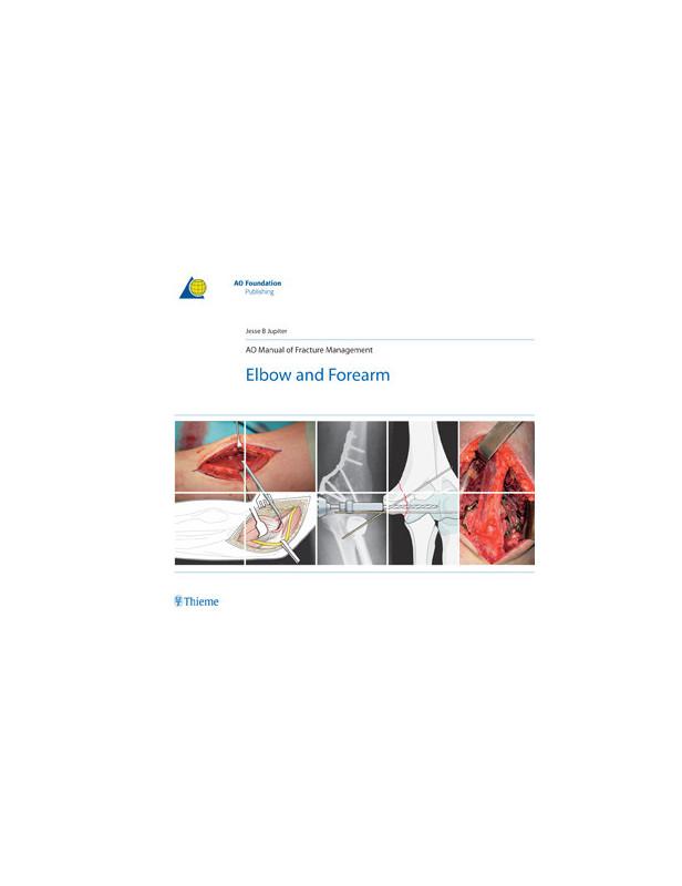AO MANUAL OF FRACTURE MANAGEMENT : ELBOW AND FOREARM