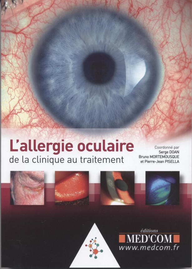 L ALLERGIE OCULAIRE DE LA CLINIQUE AU TRAITEMENT
