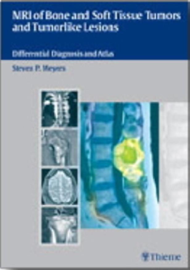 MRI OF BONE AND SOFT TISSUE TUMORS AND TUMORLIKE LESIONS, DIFFERENTIAL DIAGNOSIS