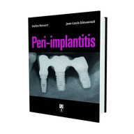 PERI-IMPLANTITIS