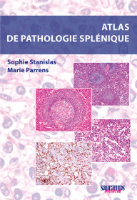 ATLAS DE PATHOLOGIE SPLENIQUE