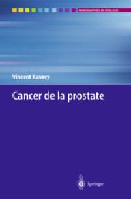 Cancer de la prostate