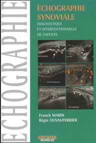 ECHOGRAPHIE SYNOVIALE...