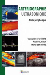 ARTERIOGRAPHIE ULTRASONIQUE
