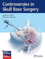 CONTROVERSIES IN SKULL BASE...