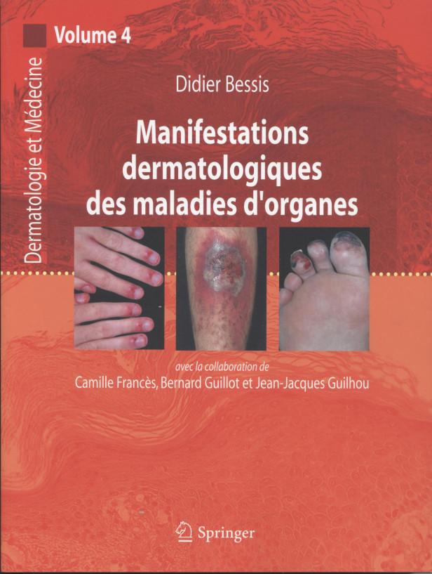 DERMATOLOGIE ET MEDECINE - T04 - MANIFESTATIONS DERMATOLOGIQUES DES MALADIES D'ORGANES