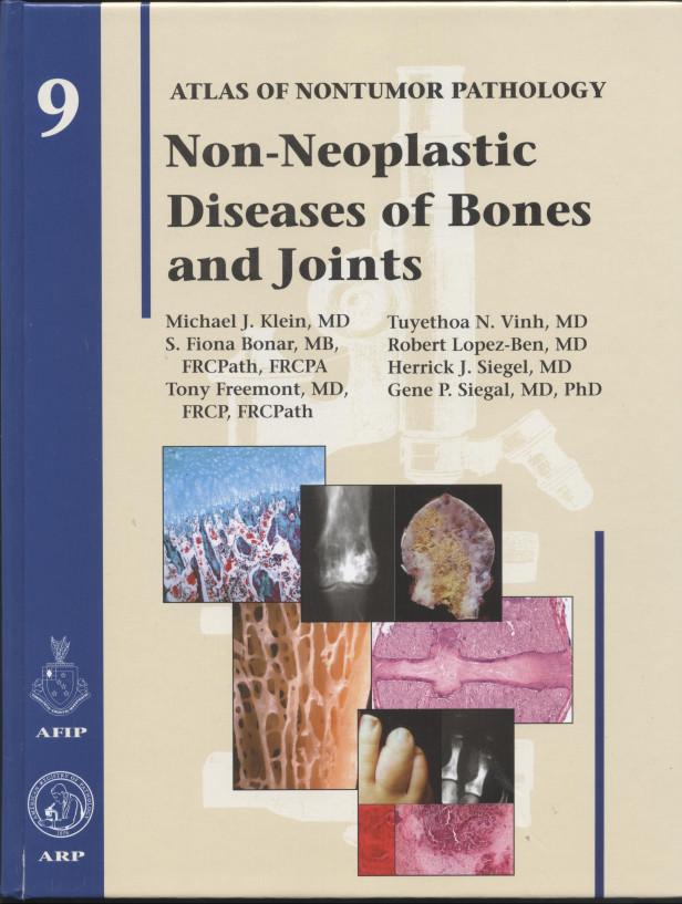 AFIP ATLAS NONTUMOR PATH. VOL.9 NON-NEOPLASTIC DISEASES OF BONES AND JOINTS