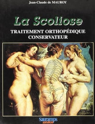LA SCOLIOSE TRAITEMENT...