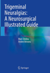 TRIGEMINAL NEURALGIAS : A...