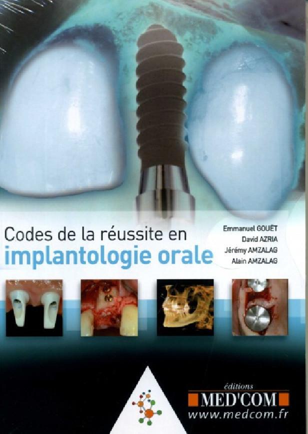 CODES DE LA REUSSITE EN IMPLANTOLOGIE ORALE