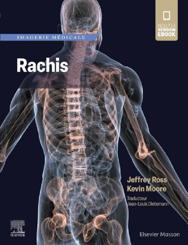 IMAGERIE MEDICALE : RACHIS