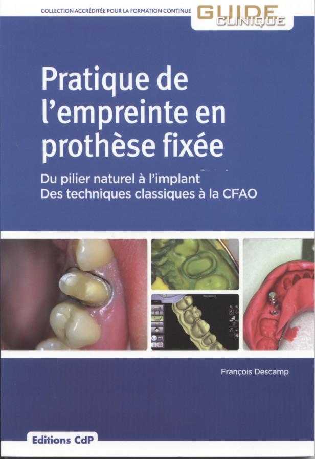 PRATIQUE DE L'EMPREINTE EN PROTHESE FIXEE - DU PILIER NATUREL A L'IMPLANT - DES TECHNIQUES CLASSIQUE