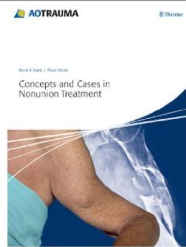 CONCEPT AND CASES IN NONUNION TREATMENT