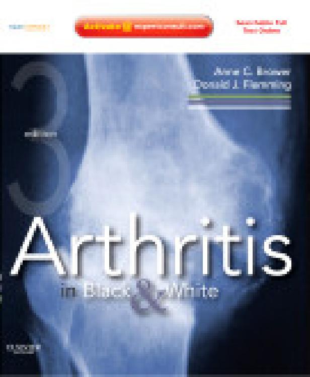 ARTHRITIS IN BLACK AND WHITE, 3RD EDITION