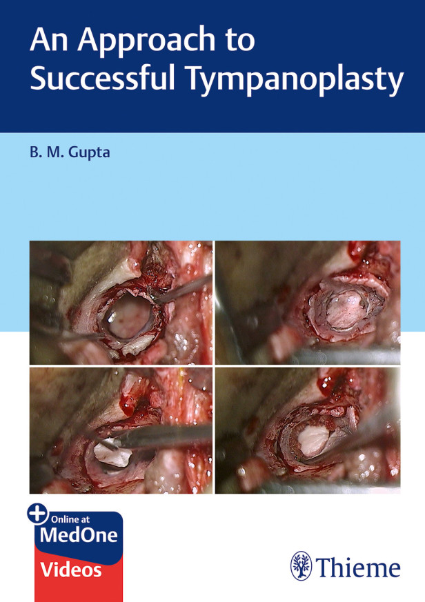 AN APPROACH TO SUCCESSFUL TYMPANOPLASTY
