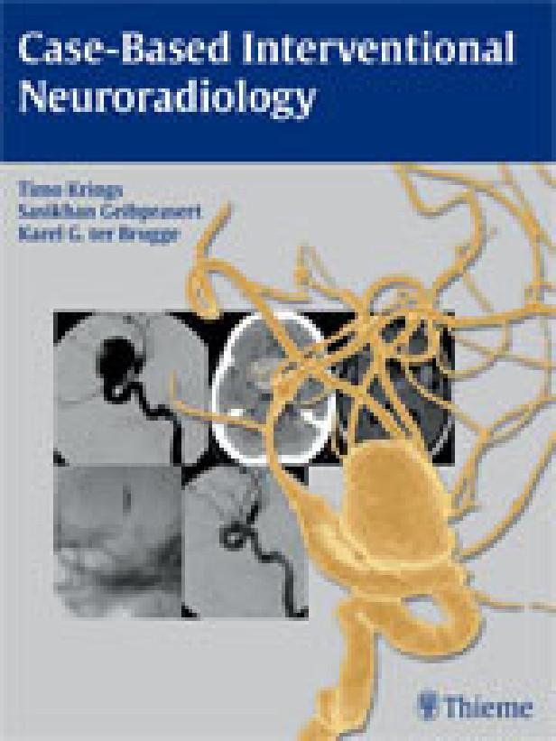 Case-based interventional neuroradiology