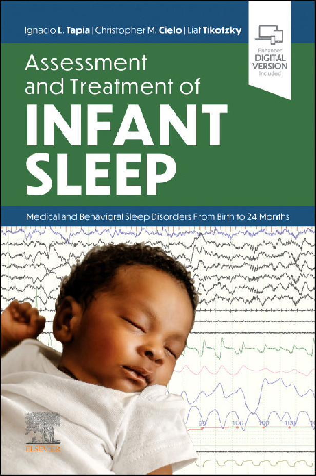 ASSESSMENT AND TREATMENT OF INFANT SLEEP