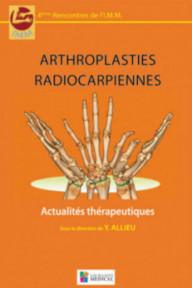 ARTHROPLASTIES RADIOCARPIENNES