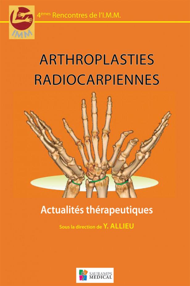 ARTHROPLASTIES RADIOCARPIENNES