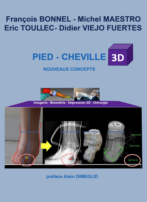 PIED ET CHEVILLE 3D - NOUVEAUX CONCEPTS