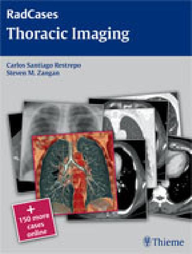 Thoracic imaging