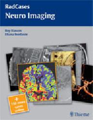 Neuroimaging rad cases