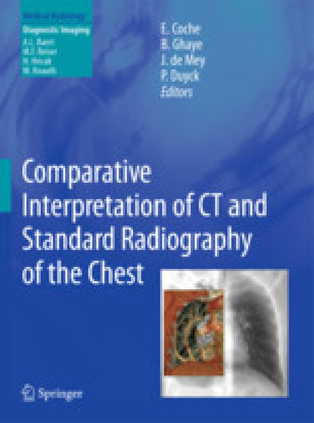 Comparative interpretation of ct and standard radiography of the chest