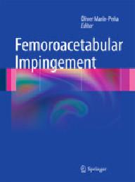 FEMOROACETABULAR IMPINGEMENT