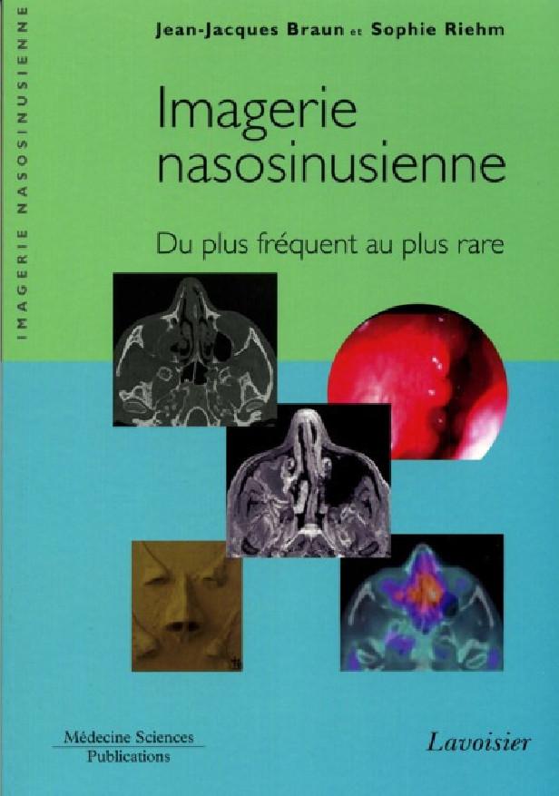 IMAGERIE NASOSINUSIENNE - DU PLUS FREQUENT AU PLUS RARE