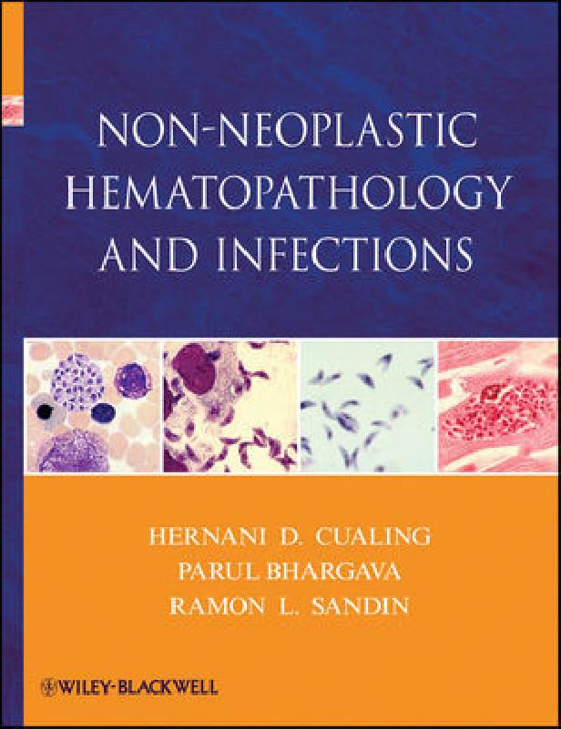 NON-NEOPLASTIC HEMATOLOGY AND INFECTIONS