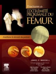 FRACTURES DE L'EXTREMITE...