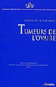 Tumeurs de l'ovaire