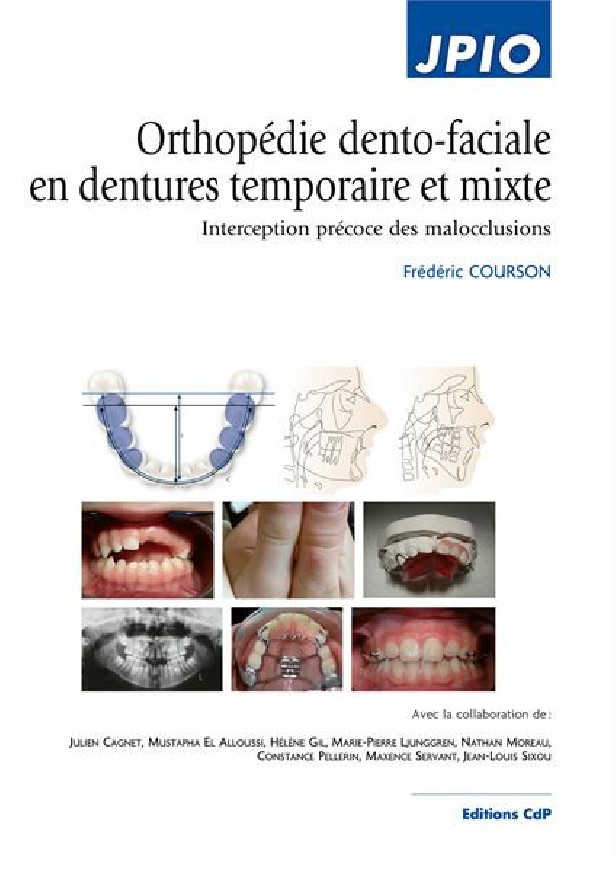 ORTHOPEDIE DENTO-FACIALE EN DENTURES TEMPORAIRE ET MIXTE - INTERCEPTION PRECOCE DES MALOCCLUSIONS