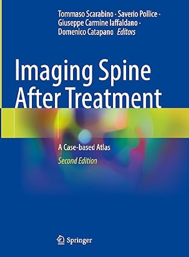 Imaging Spine After Treatment: A Case Based Atlas