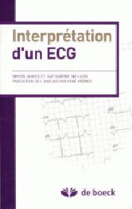 INTERPRETATION D'UN ECG
