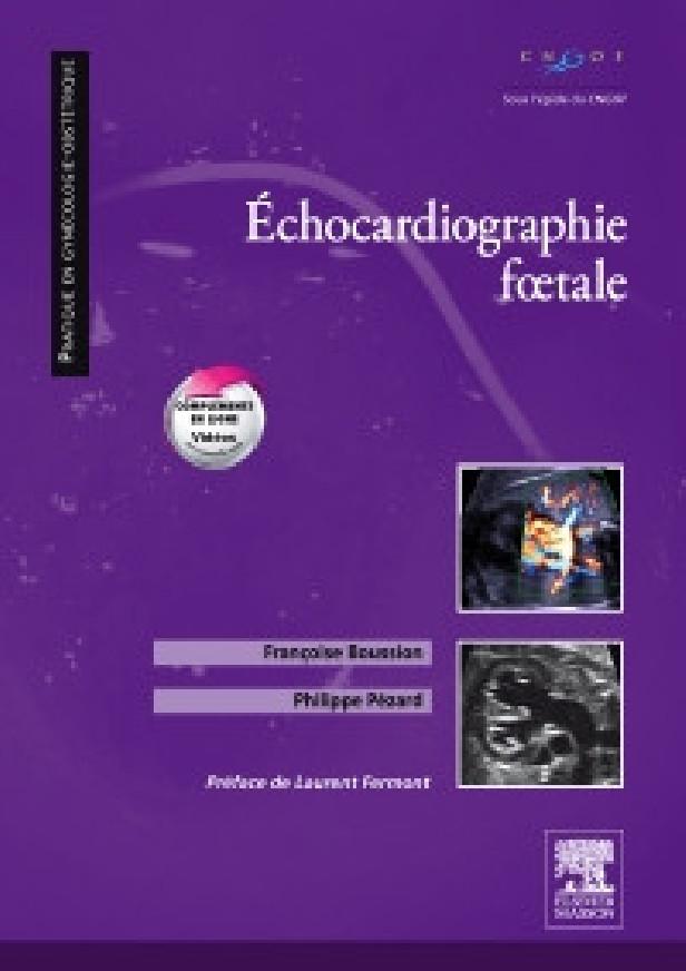 ECHOCARDIOGRAPHIE FOETALE