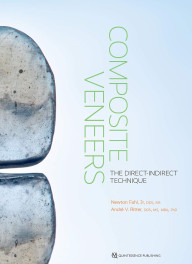 Composite veneers