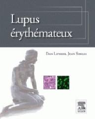LUPUS ERYTHEMATEUX
