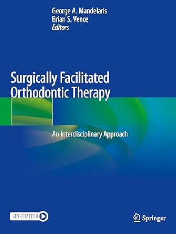 Surgically Facilitated Orthodontic Therapy