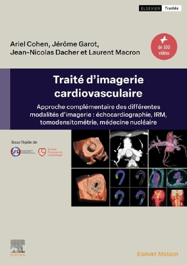 TRAITE D'IMAGERIE CARDIOVASCULAIRE - APPROCHE COMPLEMENTAIRE DES DIFFERENTES MODALITES D'IMAGERIE :