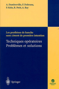 LES PROTHESES DE HANCHE...