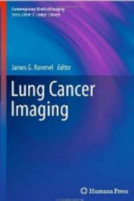 Lung cancer imaging