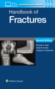 HANDBOOK OF FRACTURES 7TH...