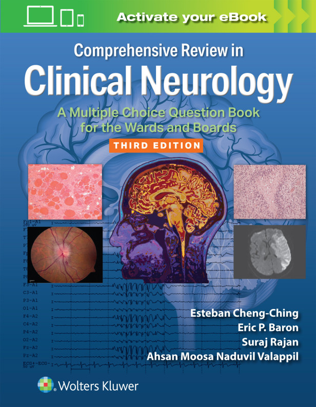 COMPREHENSIVE REVIEW IN CLINICAL NEUROLOGY 3RD EDITION
